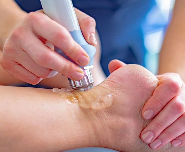 Shockwave-Therapy-Treatment-in-toronto