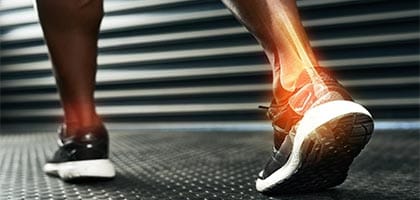 Sports-Orthotics-in-toronto
