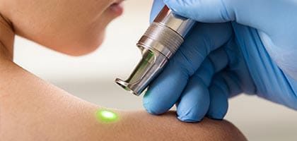 therapeutic-laser-treatment-for-rejuvenation
